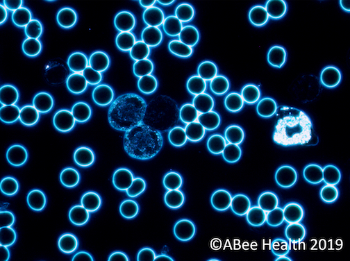 Live blood microscopy image of red blood cells