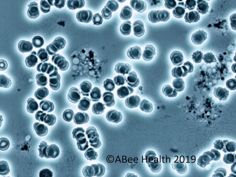Live blood microscopy image of red blood cells under phase contrast
