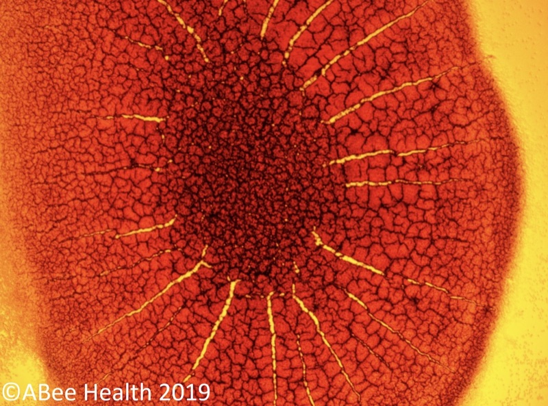 Coagulated (dried) blood microscopy image showing a radiating pattern